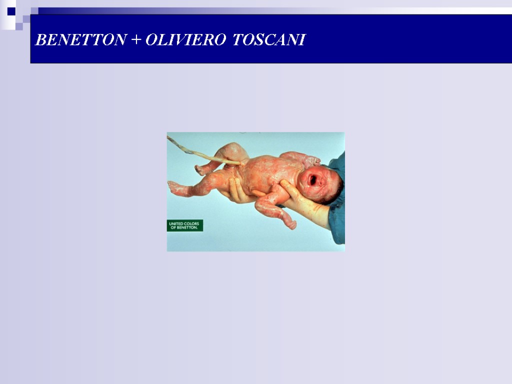 BENETTON + OLIVIERO TOSCANI